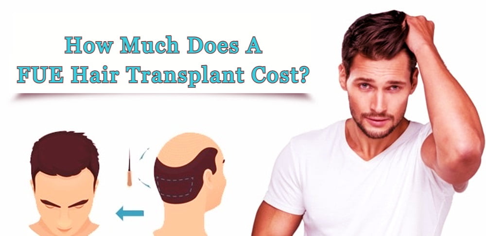 Factors affecting cost of hair transplant