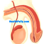 Meaning of Erectile Dysfunction (Impotence), Causes & Solutions Erectile Dysfunction Causes and treatment
