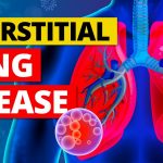 What is Childhood Interstitial Lung Disease