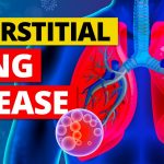 What is Childhood Interstitial Lung Disease