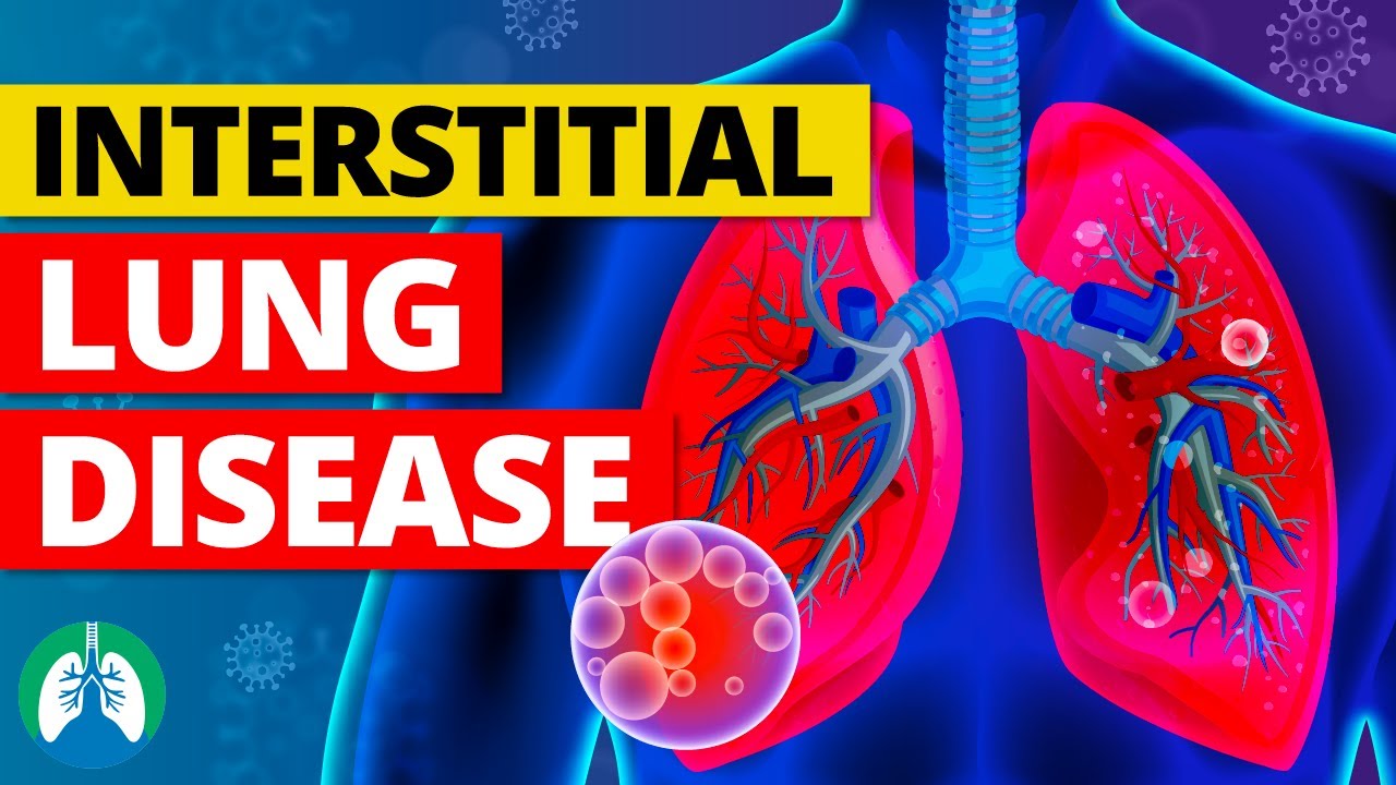What is Childhood Interstitial Lung Disease