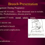 Breech position of fetus in pregnancy