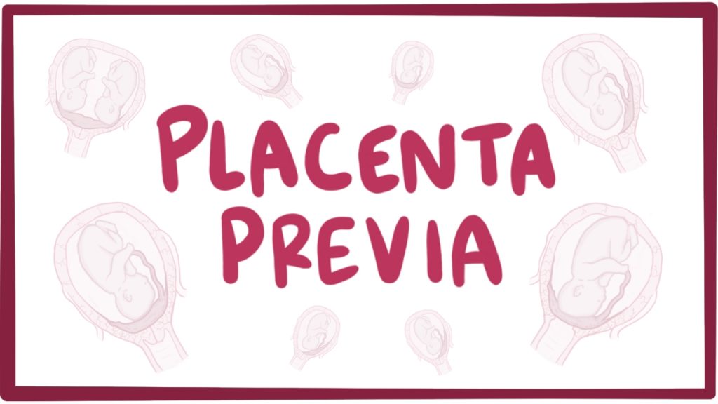 Placenta previa during pregnancy