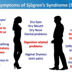 Long term effects of Sjogren's syndrome