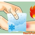 5 common causes of skin burns