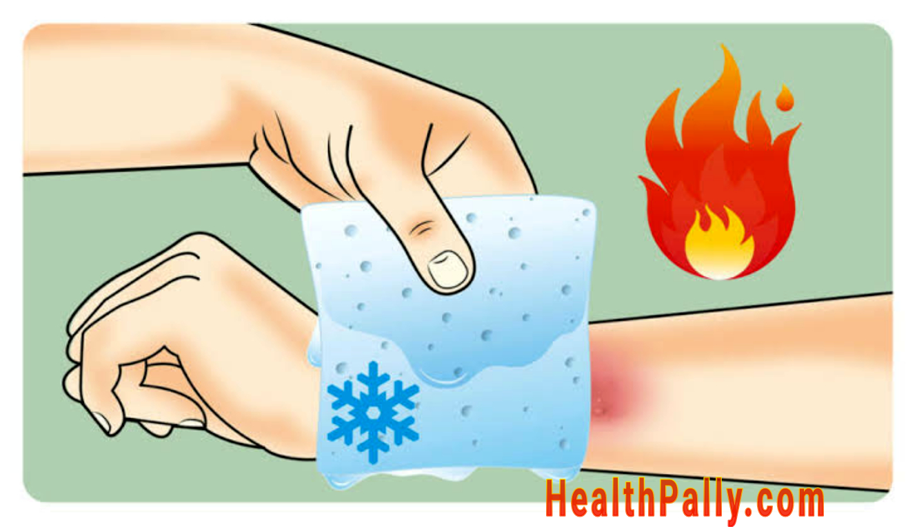 5 common causes of skin burns