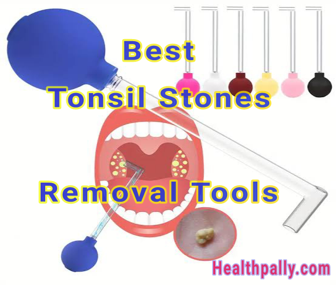 How to safely remove tonsil stones 